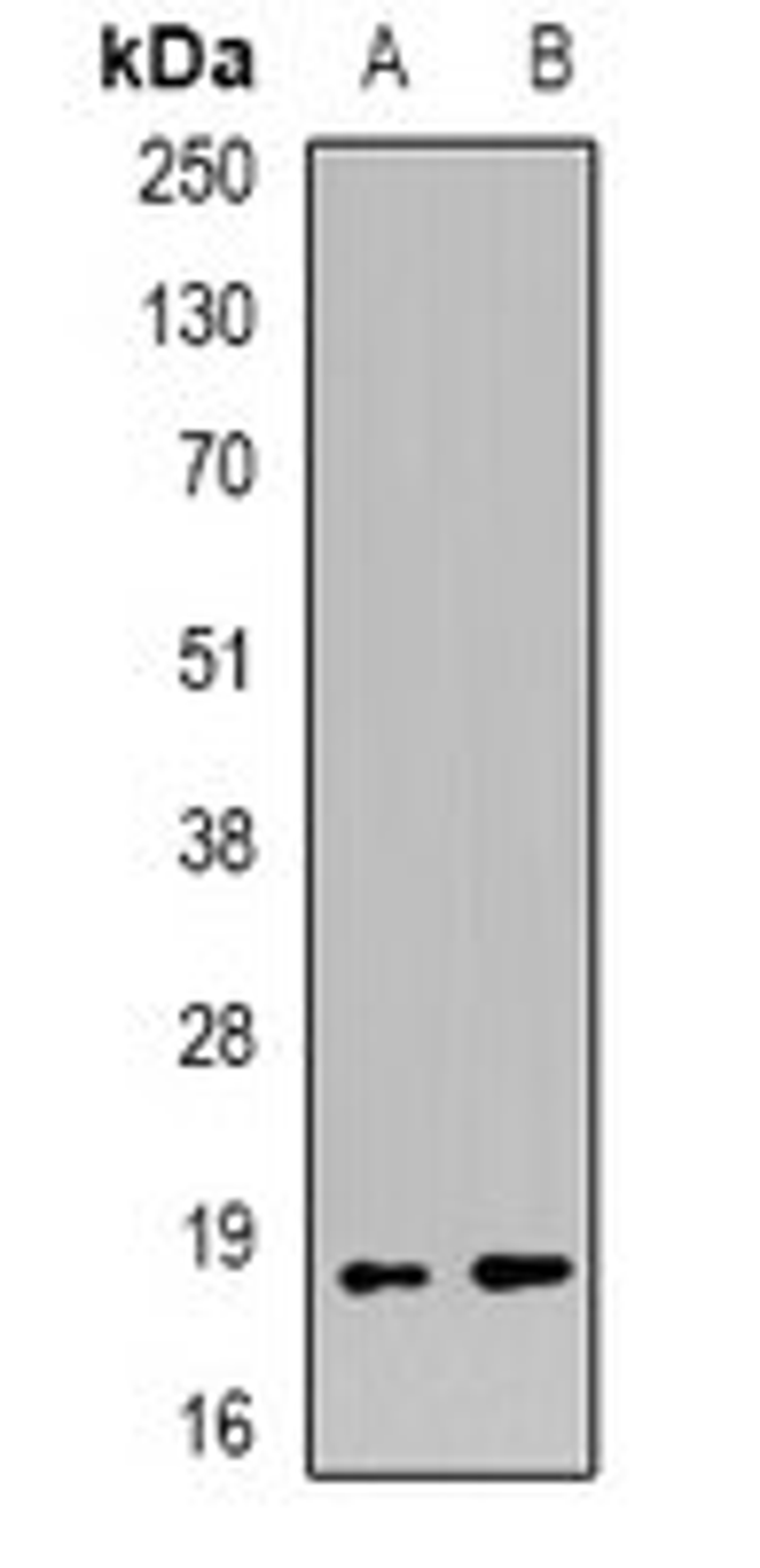 Western blot analysis of mouse kidney (Lane1), mouse heart (Lane2) whole cell lysates using MECOM antibody