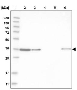 Western Blot: CLNS1A Antibody [NBP2-33958] - Lane 1: Marker [kDa] 230, 130, 95, 72, 56, 36, 28, 17, 11<br/>Lane 2: Human cell line RT-4<br/>Lane 3: Human cell line U-251MG sp<br/>Lane 4: Human plasma (IgG/HSA depleted)<br/>Lane 5: Human liver tissue<br/>Lane 6: Human tonsil tissue