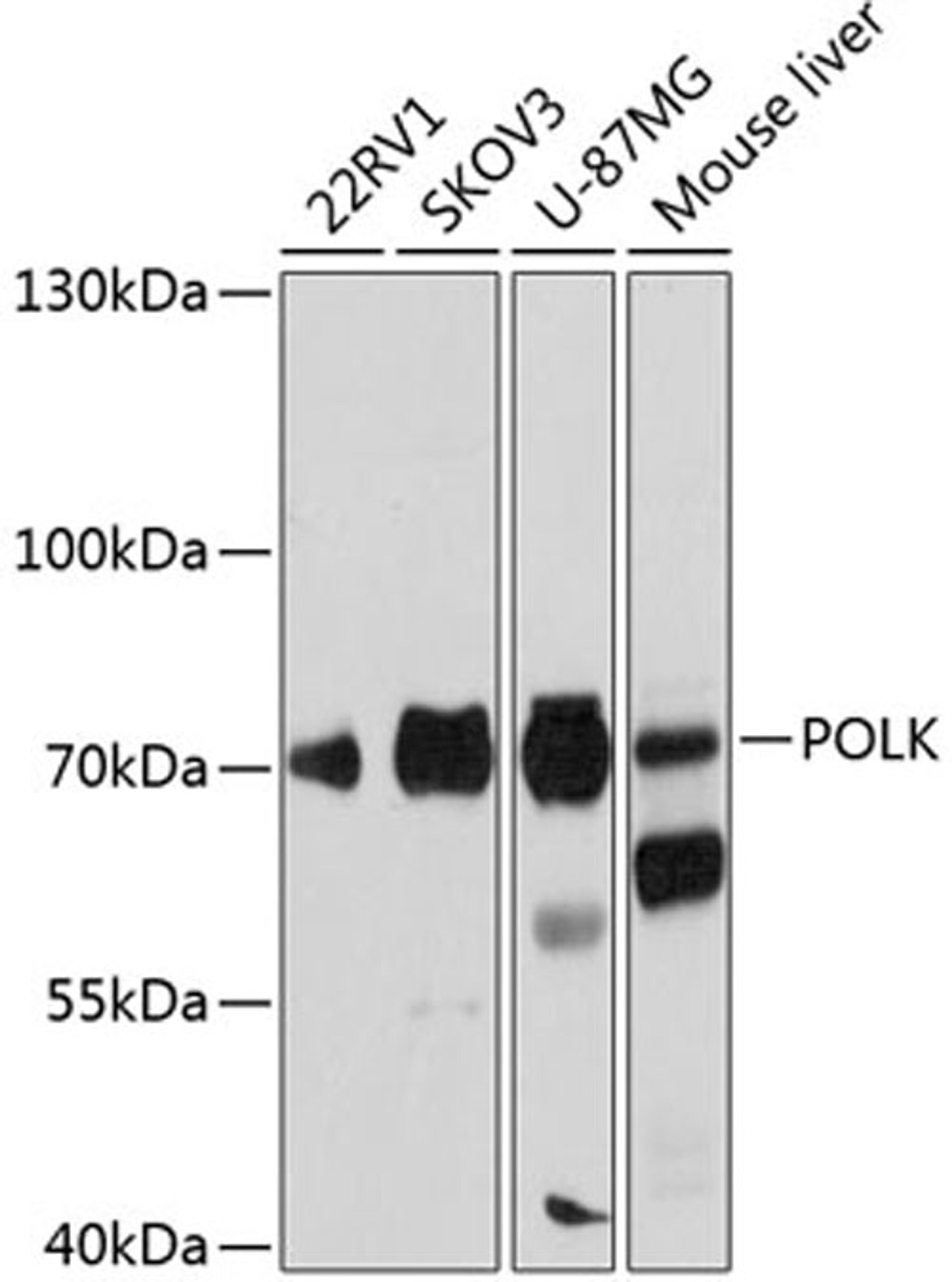 Western blot - POLK antibody (A12052)