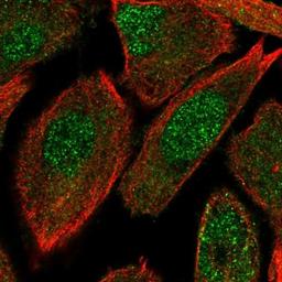 Immunocytochemistry/Immunofluorescence: OIP5 Antibody [NBP2-13688] - Staining of human cell line PC-3 shows positivity in nucleus but not nucleoli & cytoplasm.