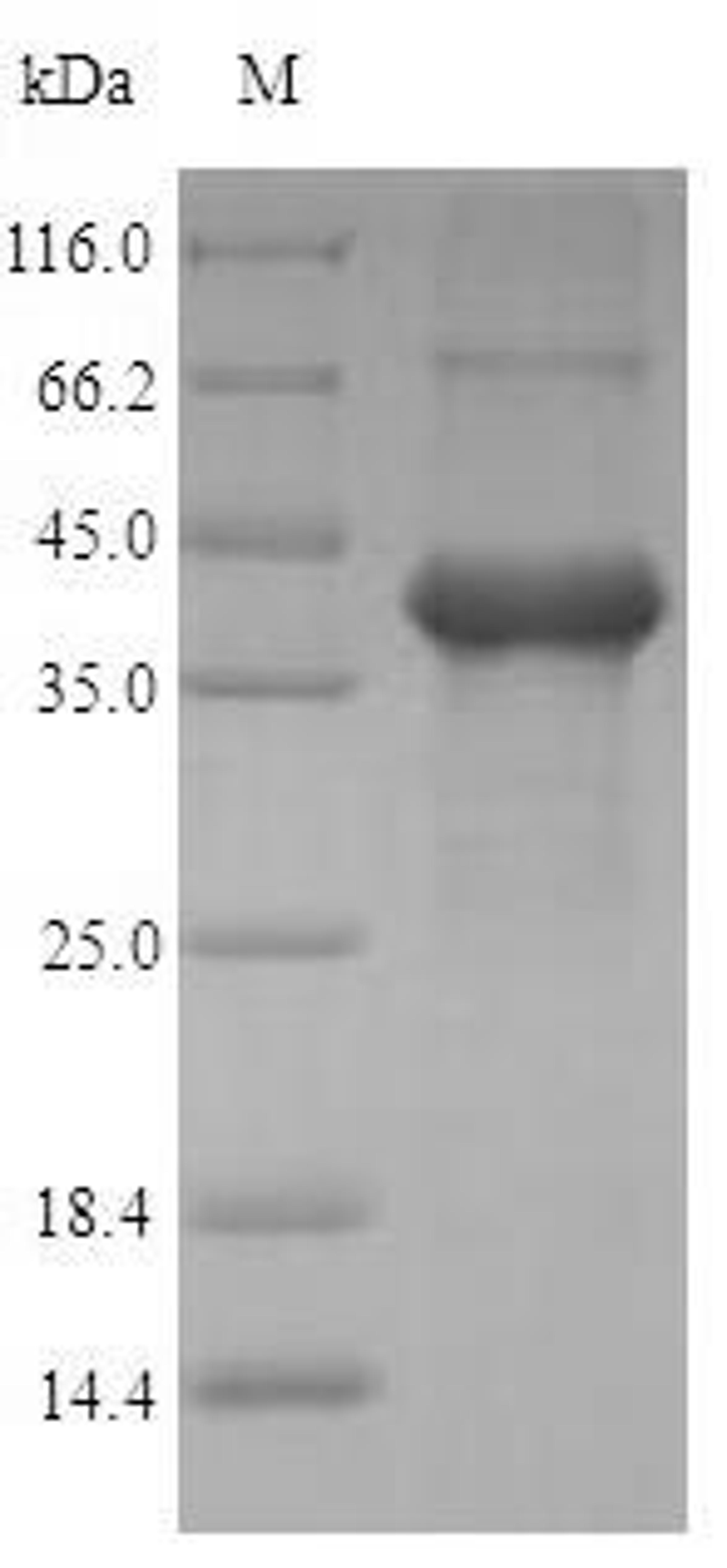 (Tris-Glycine gel) Discontinuous SDS-PAGE (reduced) with 5% enrichment gel and 15% separation gel.