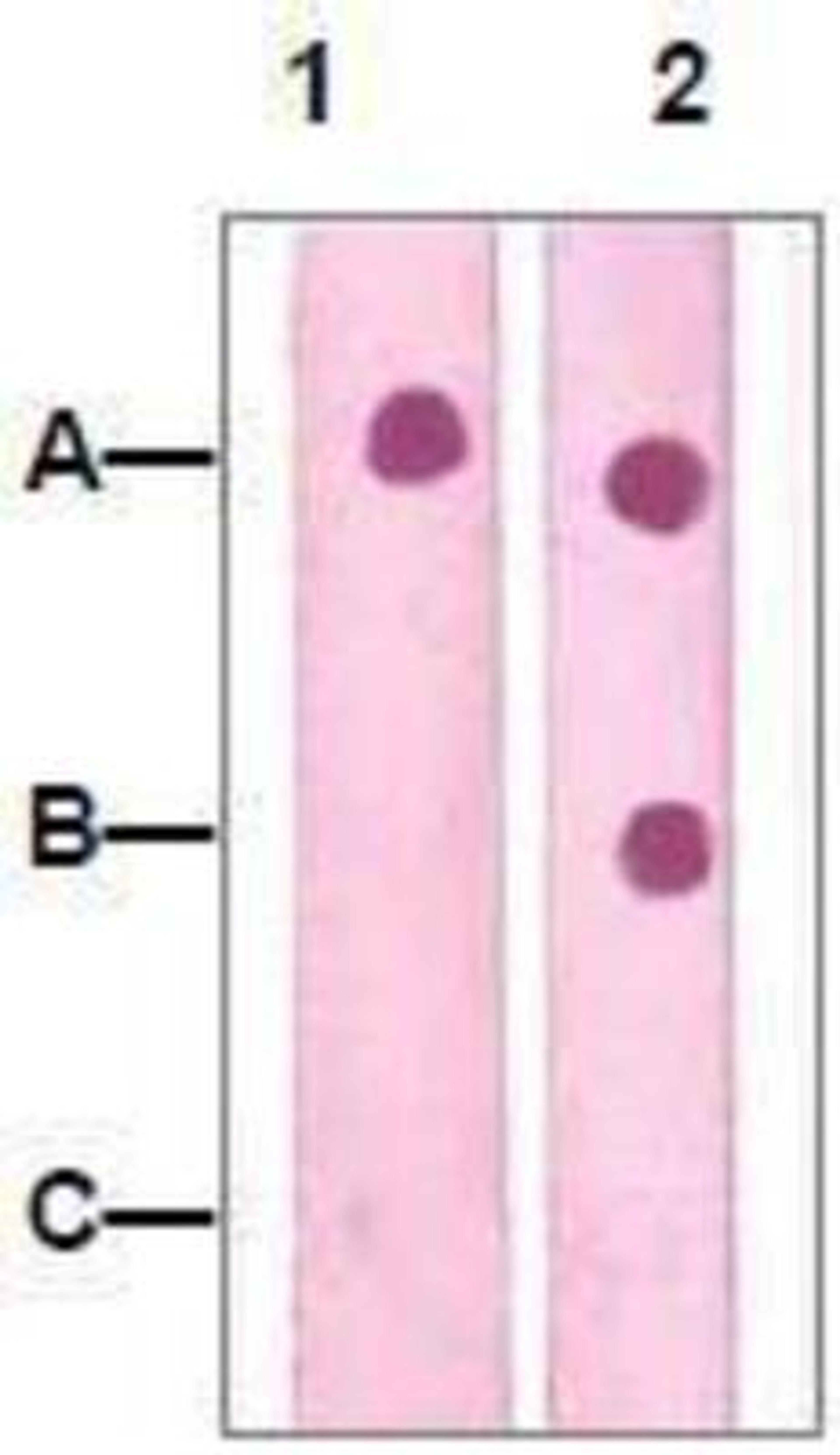 Dot Blot: PTEN Antibody [NBP1-72275] - 1 mg peptide was blot onto NC membrane: A: PTEN (pS385) (Phosphospecific) / B: PTEN (Paired S385) (Non phosphospeicfic) / C: Non-related.  Phosphospecific peptide were blotted at a 1:2000 dilution by: 1: Rabbit anti-PTEN (pS385) (Phosphospecific) / 2: Rabbit anti-PTEN (Paired) (Non-Phospho specific)