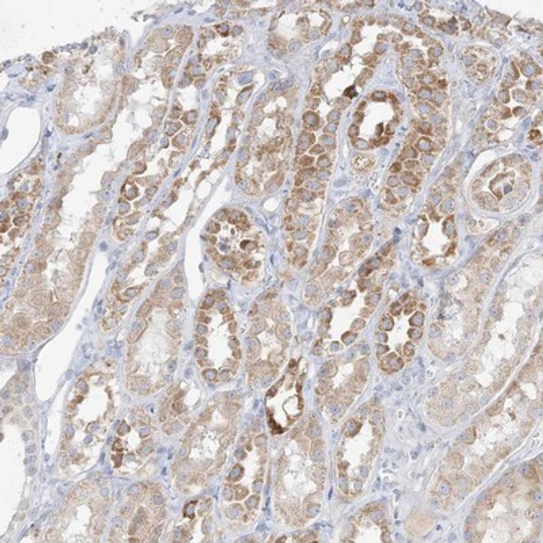 Immunohistochemistry-Paraffin: Plexin A4 Antibody [NBP1-85128] - Staining of human kidney shows moderate cytoplasmic positivity in tubular cells.