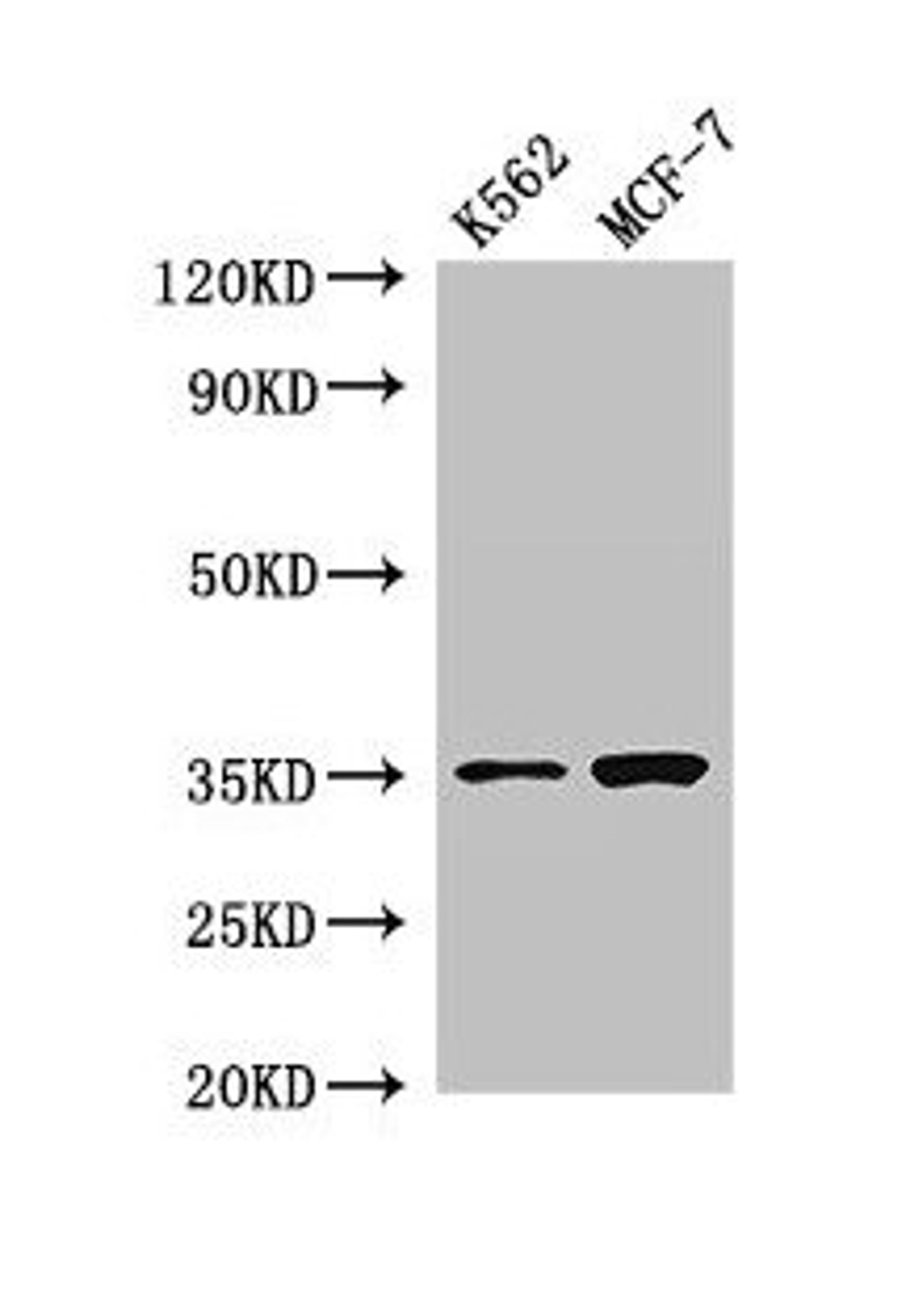 Western Blot. Positive WB detected in: K562 whole cell lysate, MCF-7 whole cell lysate. All lanes: EN2 antibody at 2.8µg/ml. Secondary. Goat polyclonal to rabbit IgG at 1/50000 dilution. Predicted band size: 35 kDa. Observed band size: 35 kDa
