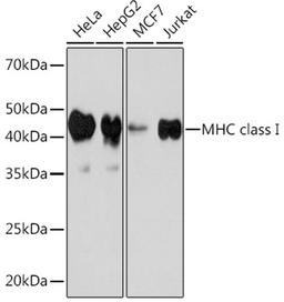 Western blot - MHC class I Rabbit mAb (A8754)