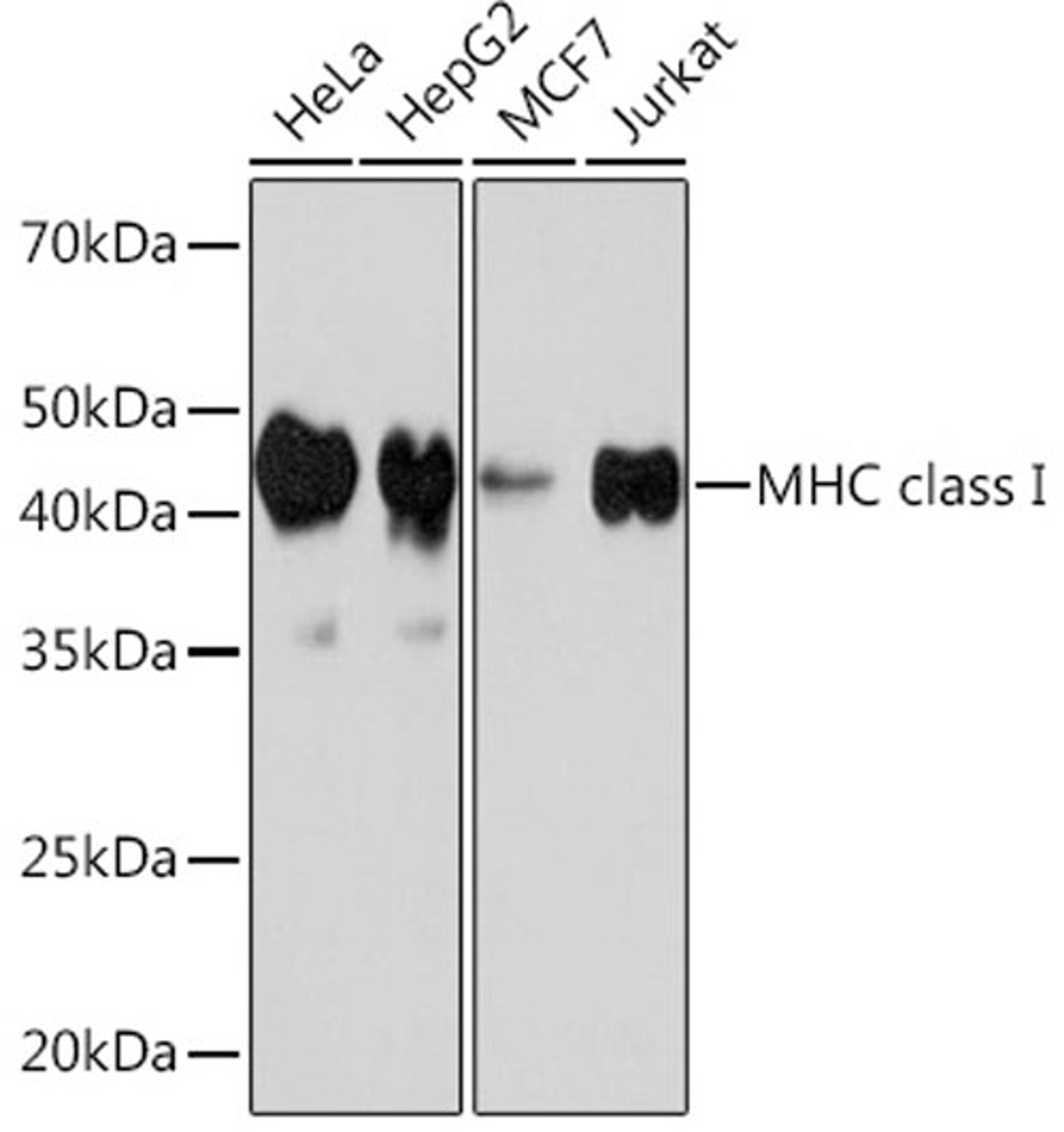 Western blot - MHC class I Rabbit mAb (A8754)