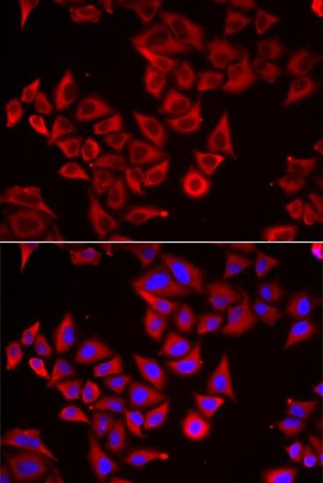 Immunofluorescense analysis of HeLa cell using SRGN antibody