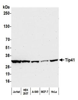 Detection of human Tip41 by western blot.