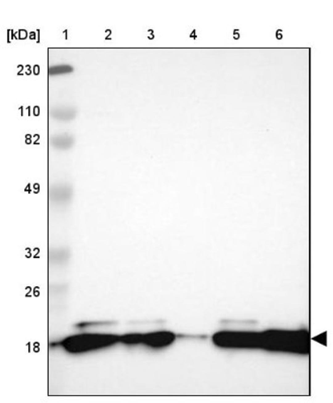 Western Blot: PNPLA4 Antibody [NBP1-84958] - Lane 1: Marker [kDa] 230, 110, 82, 49, 32, 26, 18<br/>Lane 2: Human cell line RT-4<br/>Lane 3: Human cell line U-251MG sp<br/>Lane 4: Human plasma (IgG/HSA depleted)<br/>Lane 5: Human liver tissue<br/>Lane 6: Human tonsil tissue