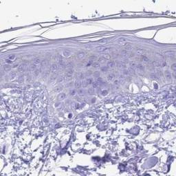 Immunohistochemistry: SULT1A2 Antibody [NBP2-31904] - Skin