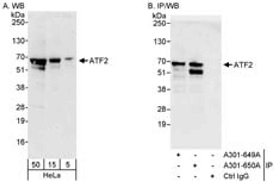 Detection of human ATF2 by western blot and immunoprecipitation.