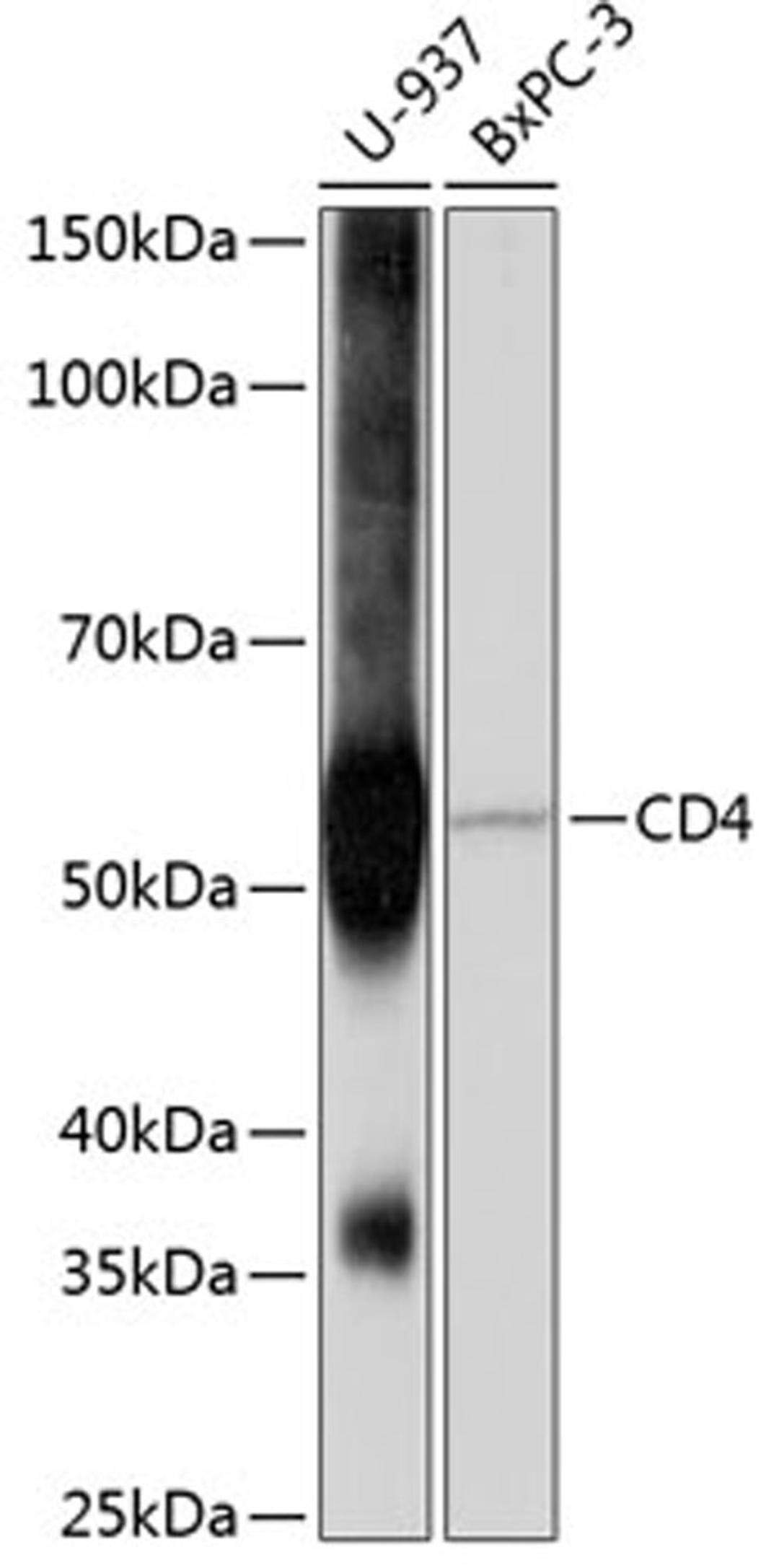 Western blot - CD4 antibody (A19018)