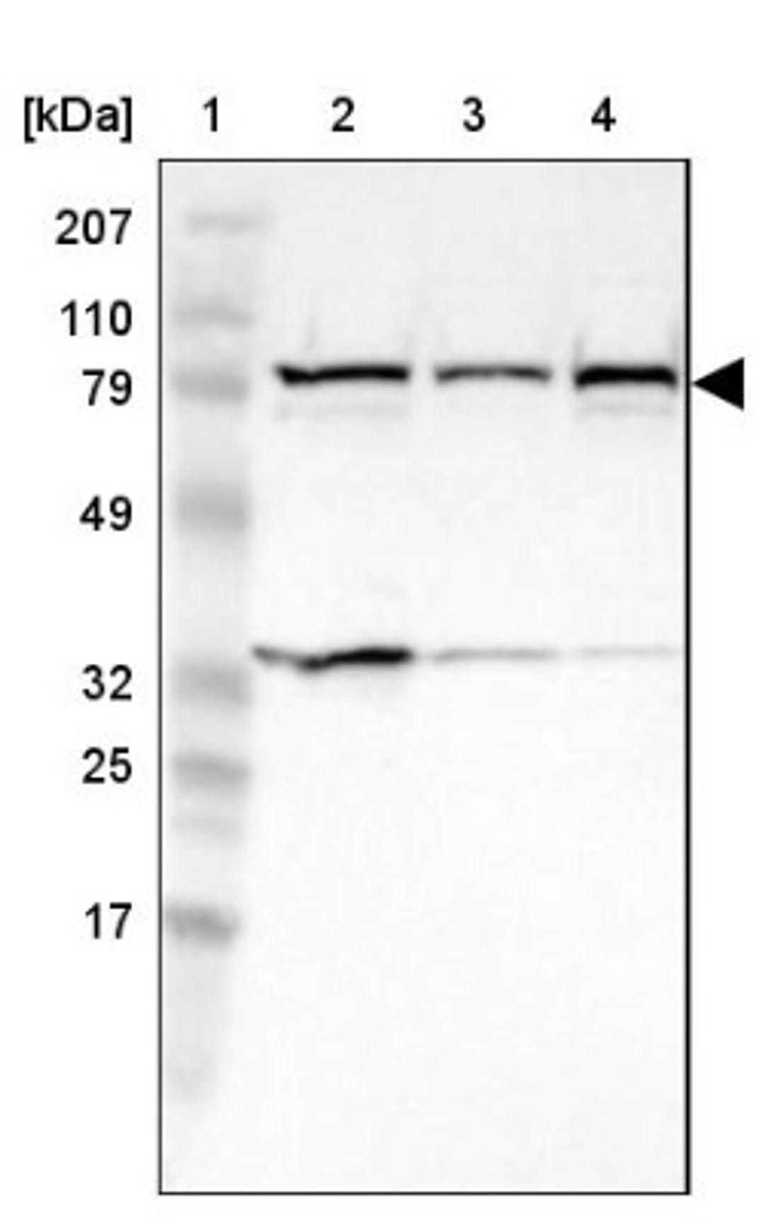 Western Blot: NSUN2 Antibody [NBP1-86878] - Lane 1: Marker [kDa] 207, 110, 79, 49, 32, 25, 17<br/>Lane 2: Human cell line RT-4<br/>Lane 3: Human cell line EFO-21<br/>Lane 4: Human cell line A-431