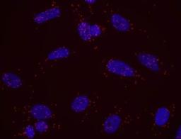 Proximity Ligation Assay: MCPH1 Antibody [NB100-575] - Secondary-conjugate Duolink II PLA in Hela cells. goat anti-human ATM (NB100-271) and rabbit anti-human MCPH1 (NB100-575). Image merged from DAPI (2ms) and Texas Red (200ms) exposures, 40X magnification.