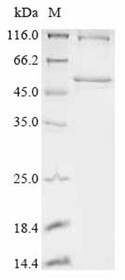 (Tris-Glycine gel) Discontinuous SDS-PAGE (reduced) with 5% enrichment gel and 15% separation gel.