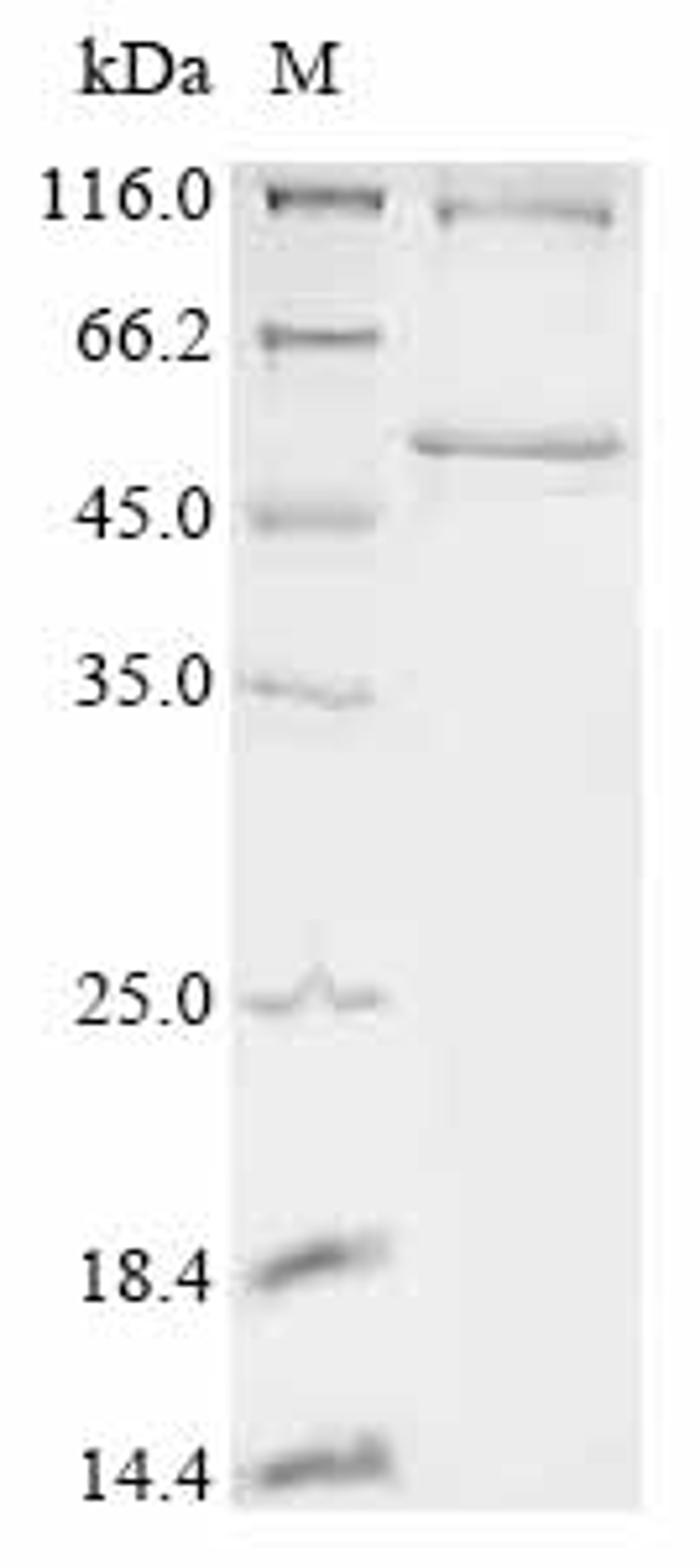 (Tris-Glycine gel) Discontinuous SDS-PAGE (reduced) with 5% enrichment gel and 15% separation gel.