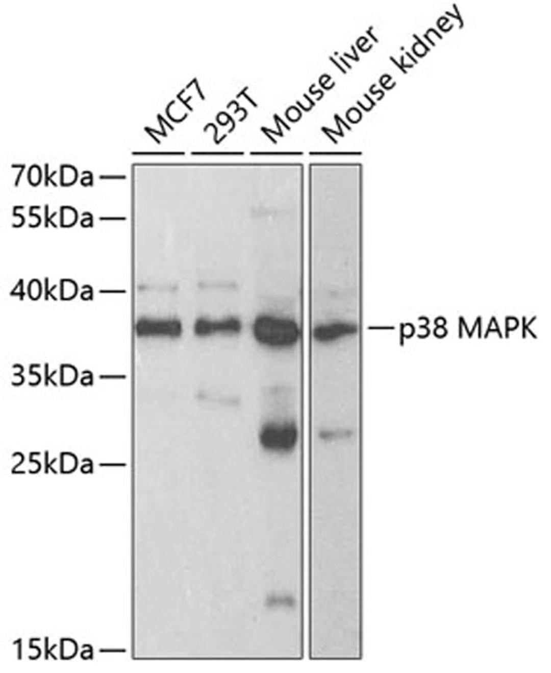 Western blot - p38 MAPK antibody (A11340)