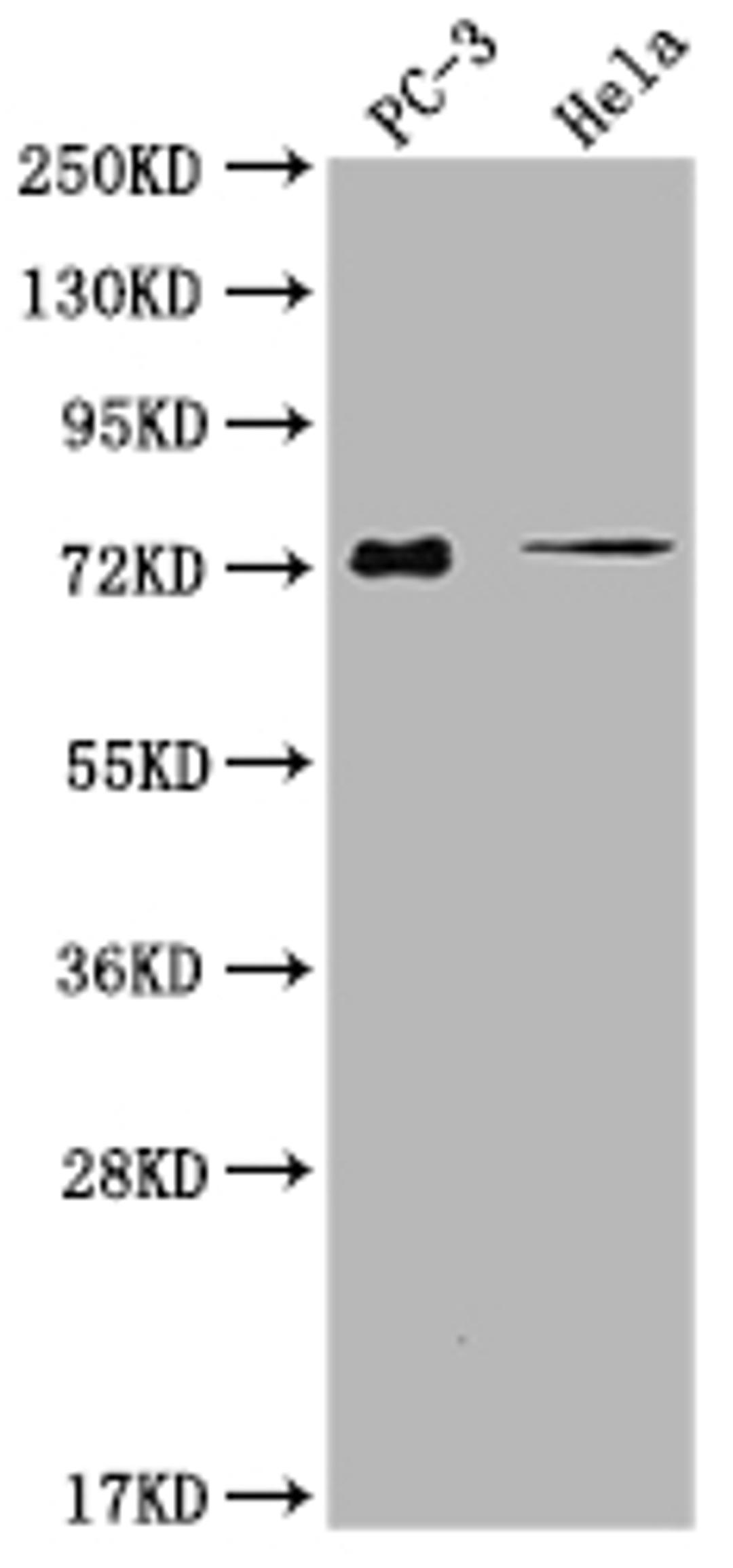 Western Blot. Positive WB detected in: PC-3 whole cell lysate, Hela whole cell lysate. All lanes: GLB1L3 antibody at 1:2000. Secondary. Goat polyclonal to rabbit IgG at 1/50000 dilution. Predicted band size: 75, 36 kDa. Observed band size: 75 kDa. 