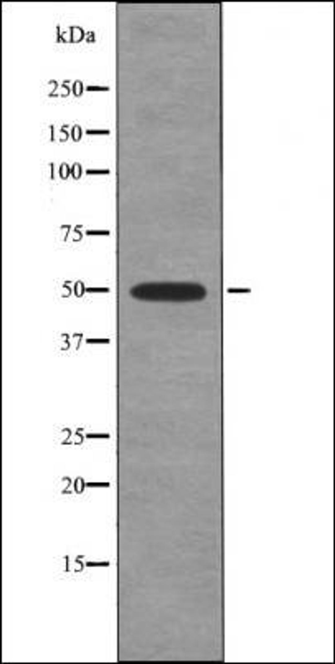 Western blot analysis of nocodazole treated HeLa whole cell lysates using Hic-5 -Phospho-Tyr60- antibody