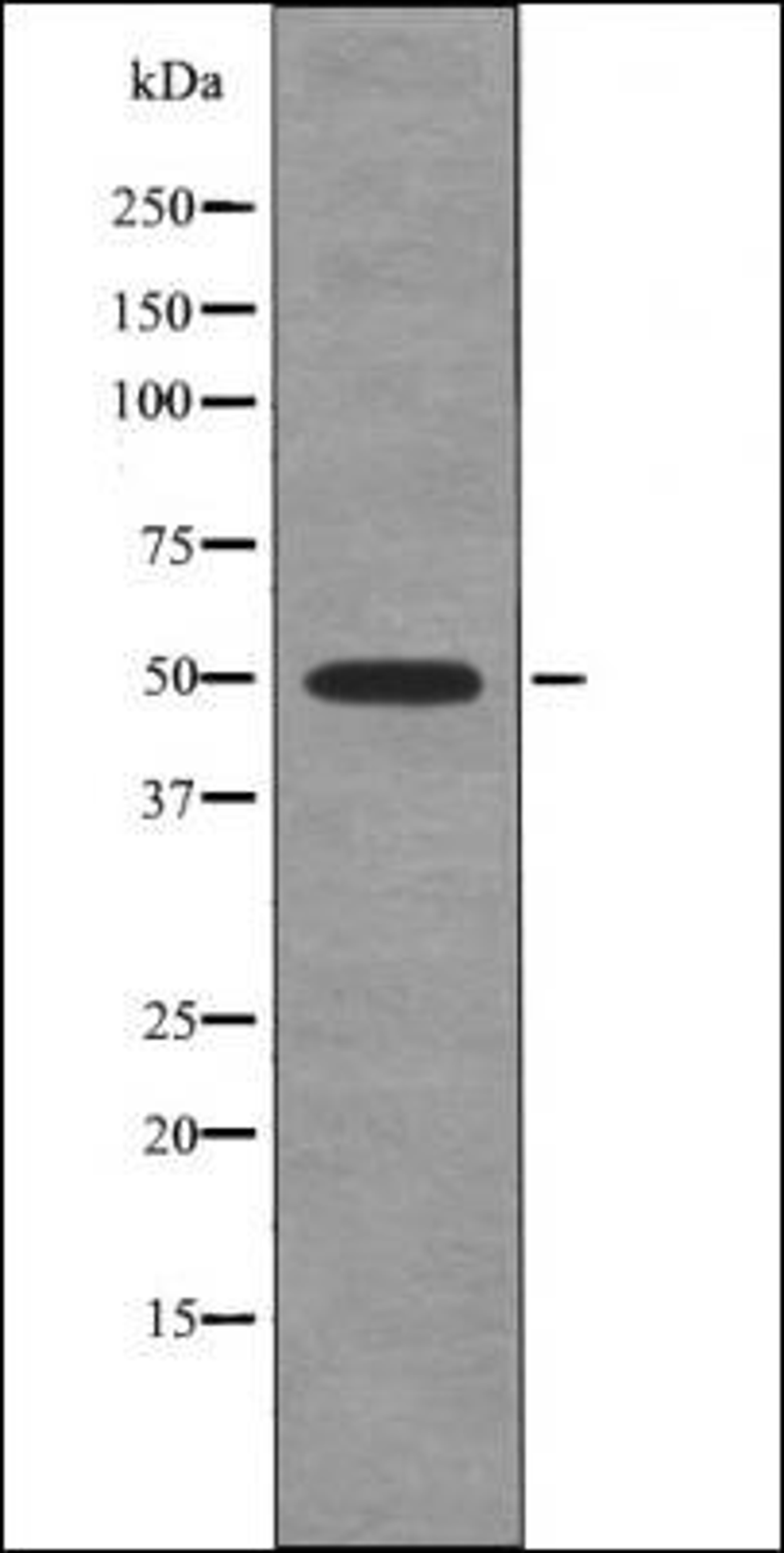 Western blot analysis of nocodazole treated HeLa whole cell lysates using Hic-5 -Phospho-Tyr60- antibody