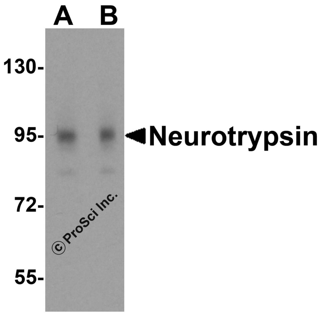Western blot analysis of neurotrypsin in 3T3 cell lysate with neurotrypsin antibody at (A) 0.25 and (B) 0.5 μg/mL.