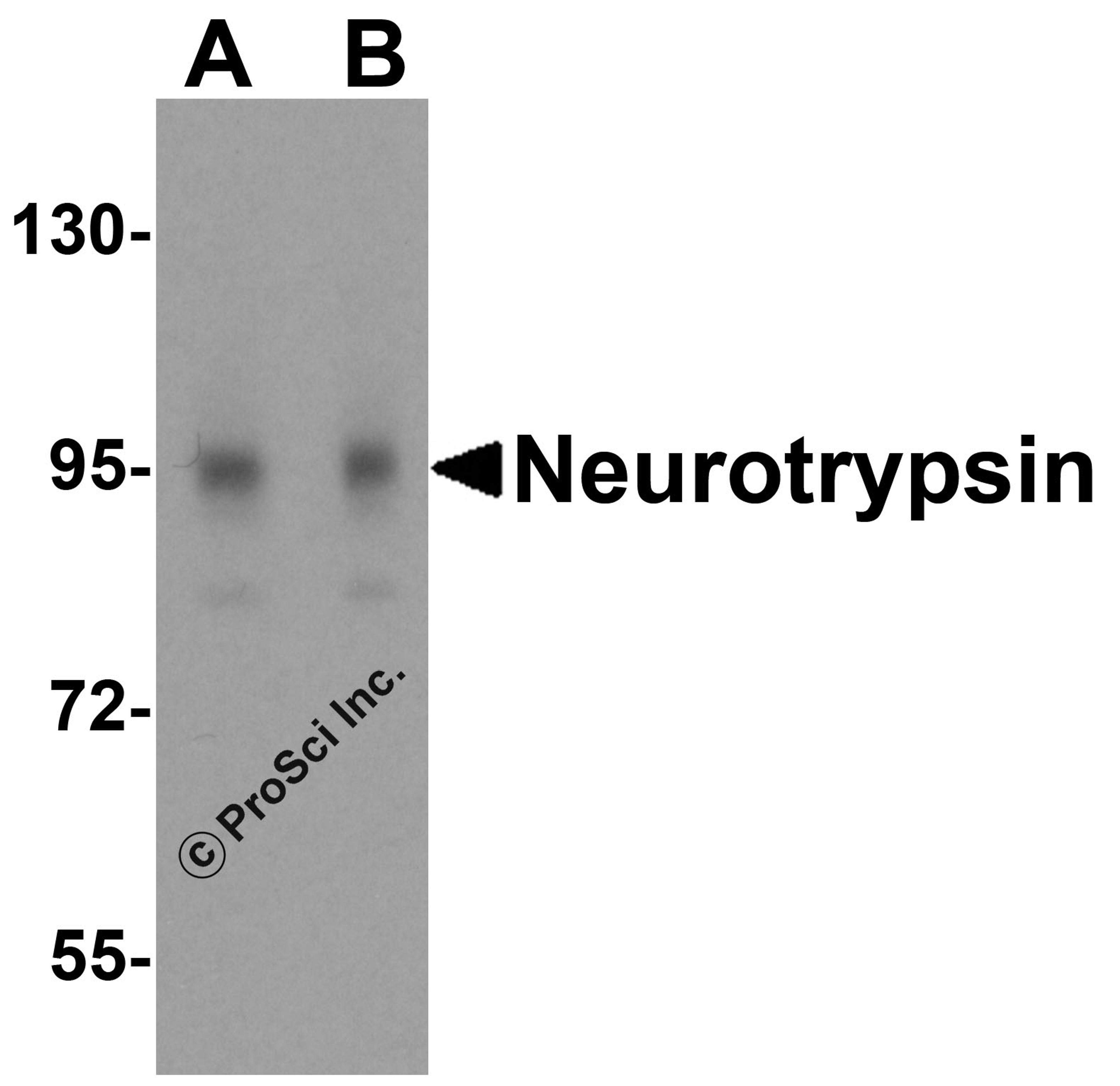 Western blot analysis of neurotrypsin in 3T3 cell lysate with neurotrypsin antibody at (A) 0.25 and (B) 0.5 μg/mL.