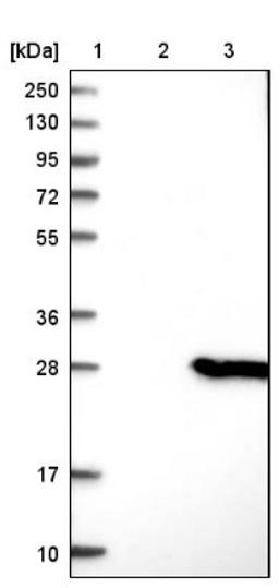 Western Blot: PIPPIN Antibody [NBP1-87271] - Lane 1: Marker [kDa] 250, 130, 95, 72, 55, 36, 28, 17, 10<br/>Lane 2: Negative control (vector only transfected HEK293T lysate)<br/>Lane 3: Over-expression lysate (Co-expressed with a C-terminal myc-DDK tag (~3.1 kDa) in mammalian HEK293T cells, LY415263)