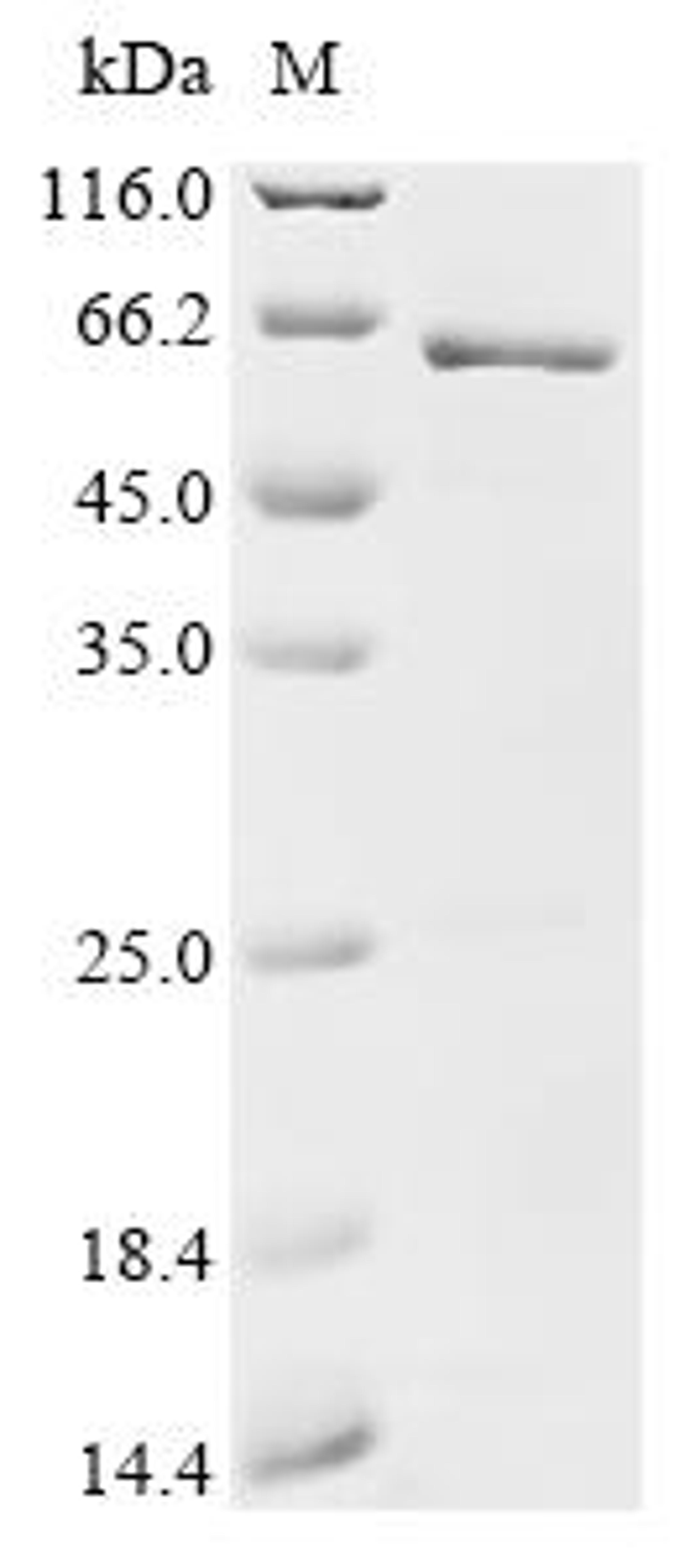 (Tris-Glycine gel) Discontinuous SDS-PAGE (reduced) with 5% enrichment gel and 15% separation gel.