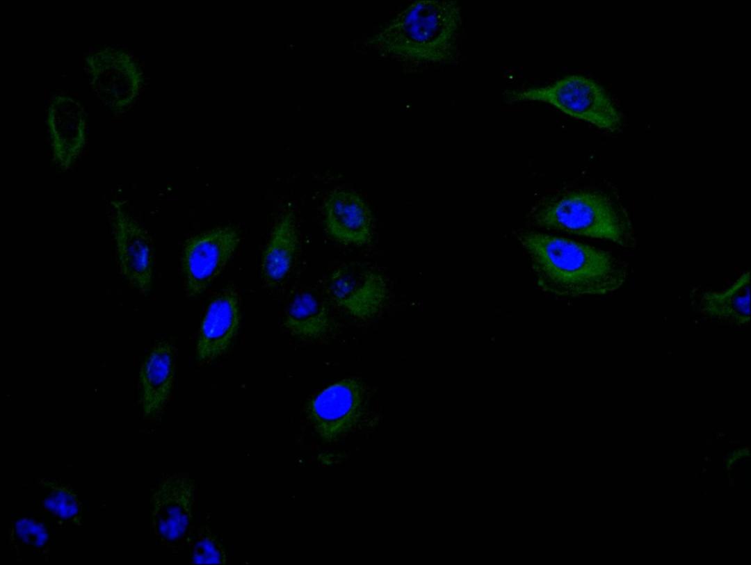 Immunofluorescence staining of A549 cell with CSB-RA004936MA1HU at 1:30, counter-stained with DAPI. The cells were fixed in 4% formaldehyde and blocked in 10% normal Goat Serum. The cells were then incubated with the antibody overnight at 4C. The secondary antibody was FITC-conjugated AffiniPure Goat Anti-mouse IgG(H+L).