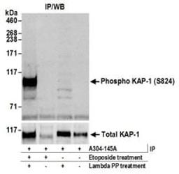 Detection of mouse Phospho KAP-1 (S824) by western blot of immunoprecipitates.