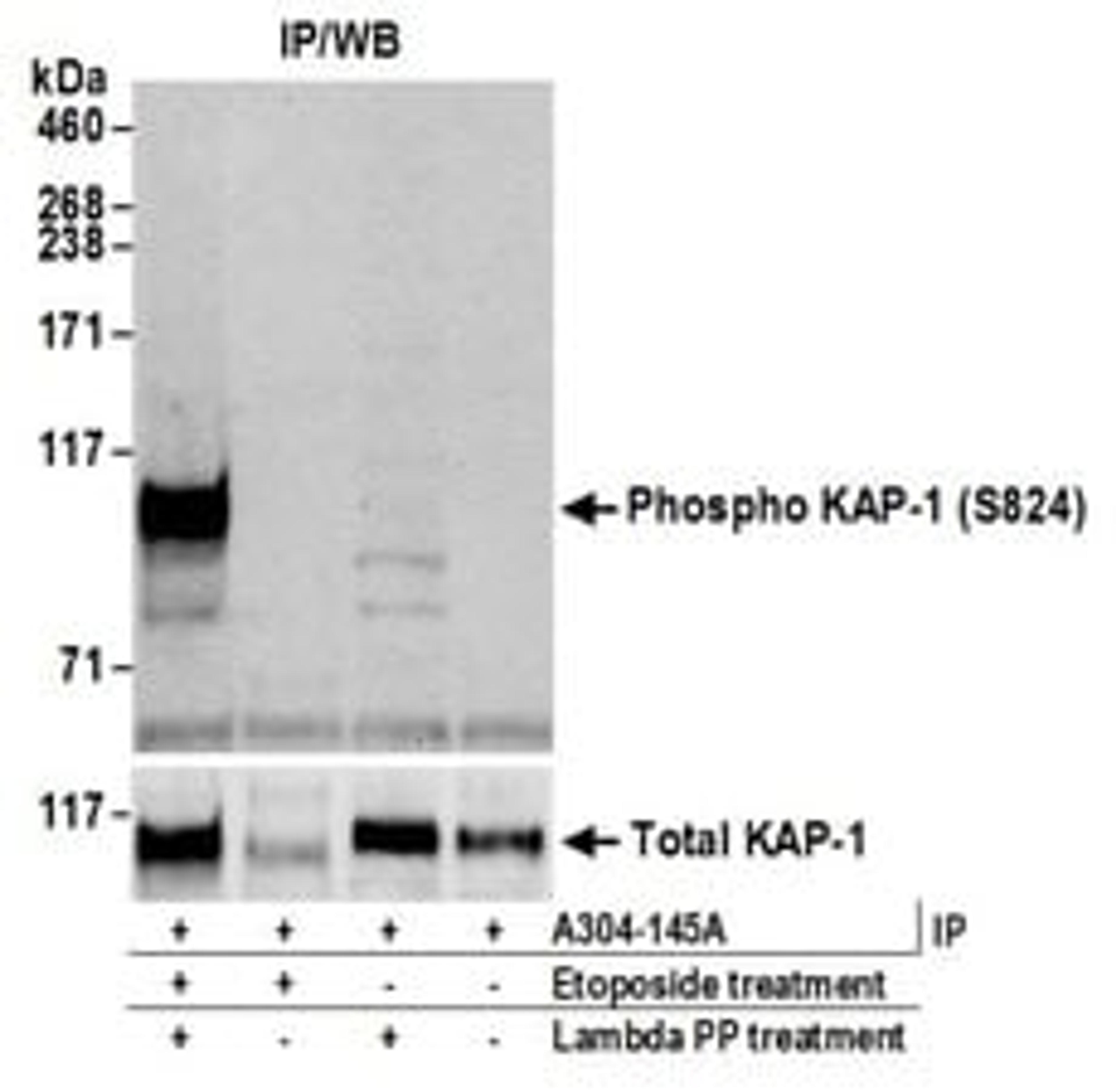 Detection of mouse Phospho KAP-1 (S824) by western blot of immunoprecipitates.