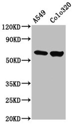Western Blot. Positive WB detected in: A549 whole cell lysate, Colo320 whole cell lysate. All lanes: PDILT antibody at 4.63ug/ml. Secondary. Goat polyclonal to rabbit IgG at 1/50000 dilution. Predicted band size: 67 kDa. Observed band size: 67 kDa.