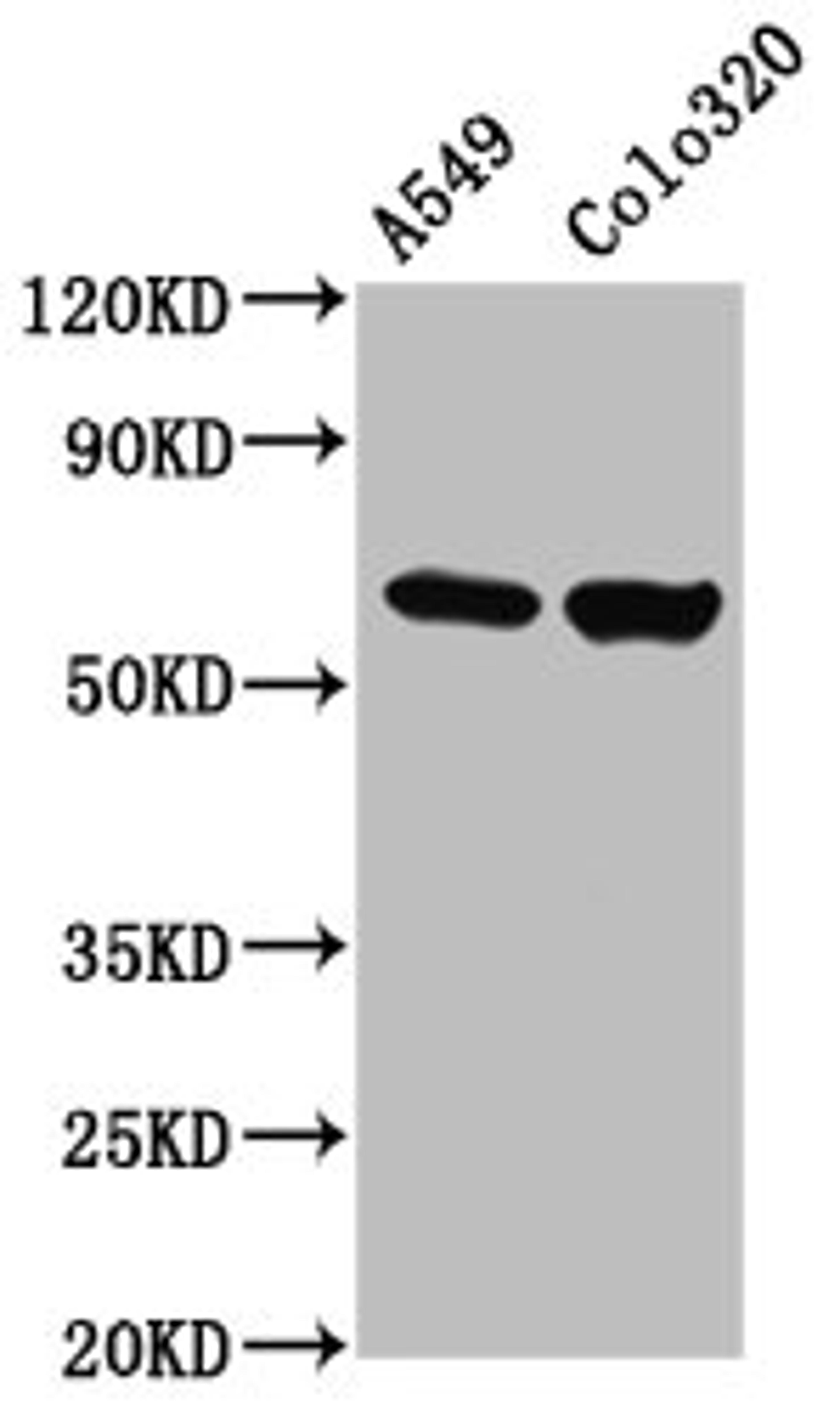 Western Blot. Positive WB detected in: A549 whole cell lysate, Colo320 whole cell lysate. All lanes: PDILT antibody at 4.63ug/ml. Secondary. Goat polyclonal to rabbit IgG at 1/50000 dilution. Predicted band size: 67 kDa. Observed band size: 67 kDa.
