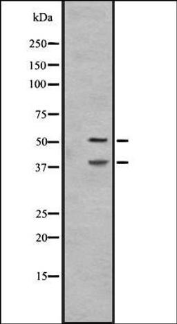 Western blot analysis of A431 whole cell lysate using IL27A antibody