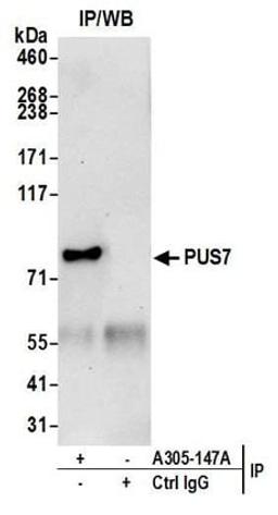 Detection of human PUS7 by western blot of immunoprecipitates.