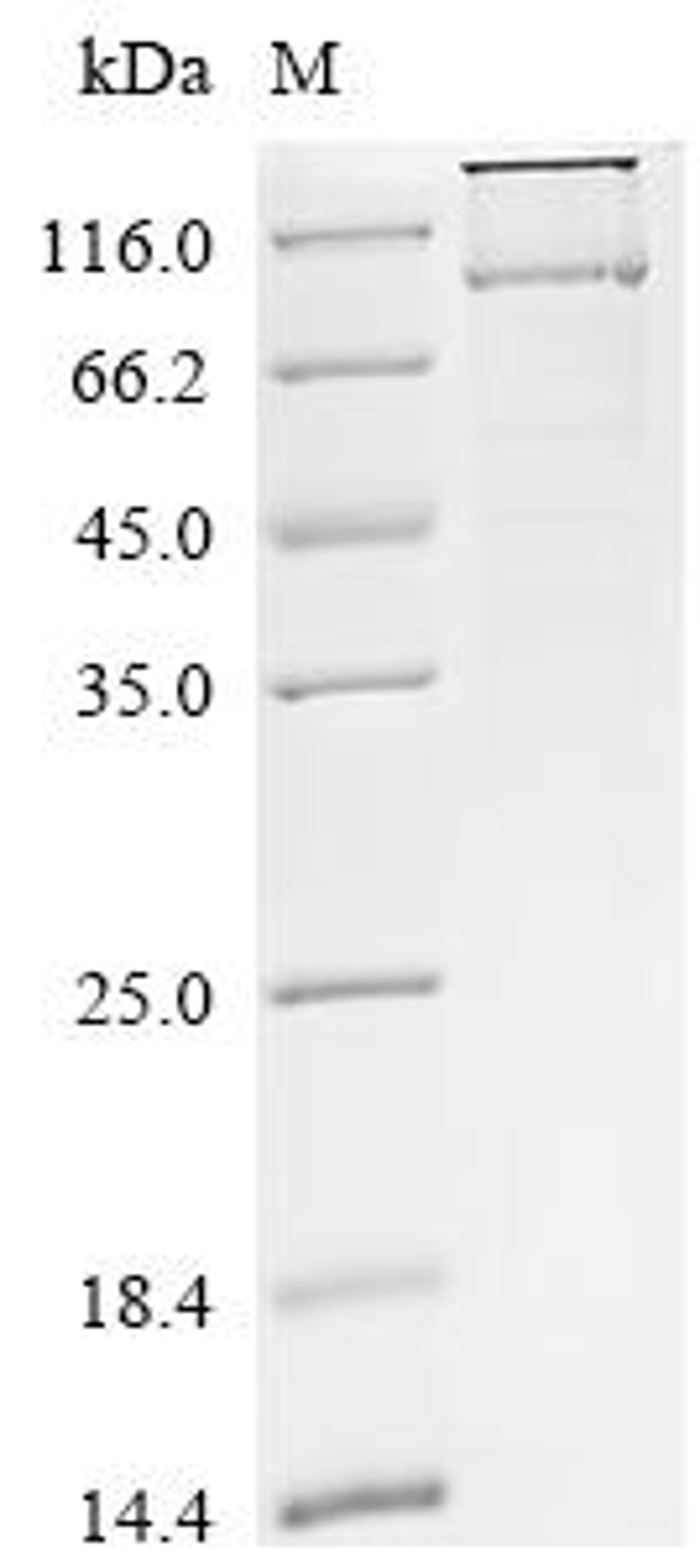 (Tris-Glycine gel) Discontinuous SDS-PAGE (reduced) with 5% enrichment gel and 15% separation gel.