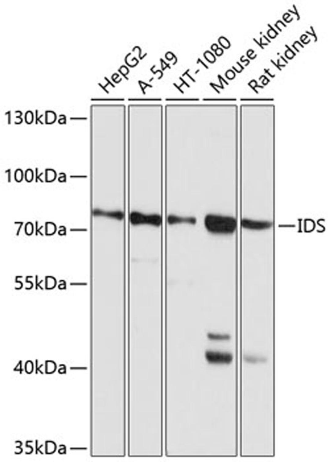 Western blot - IDS antibody (A1857)