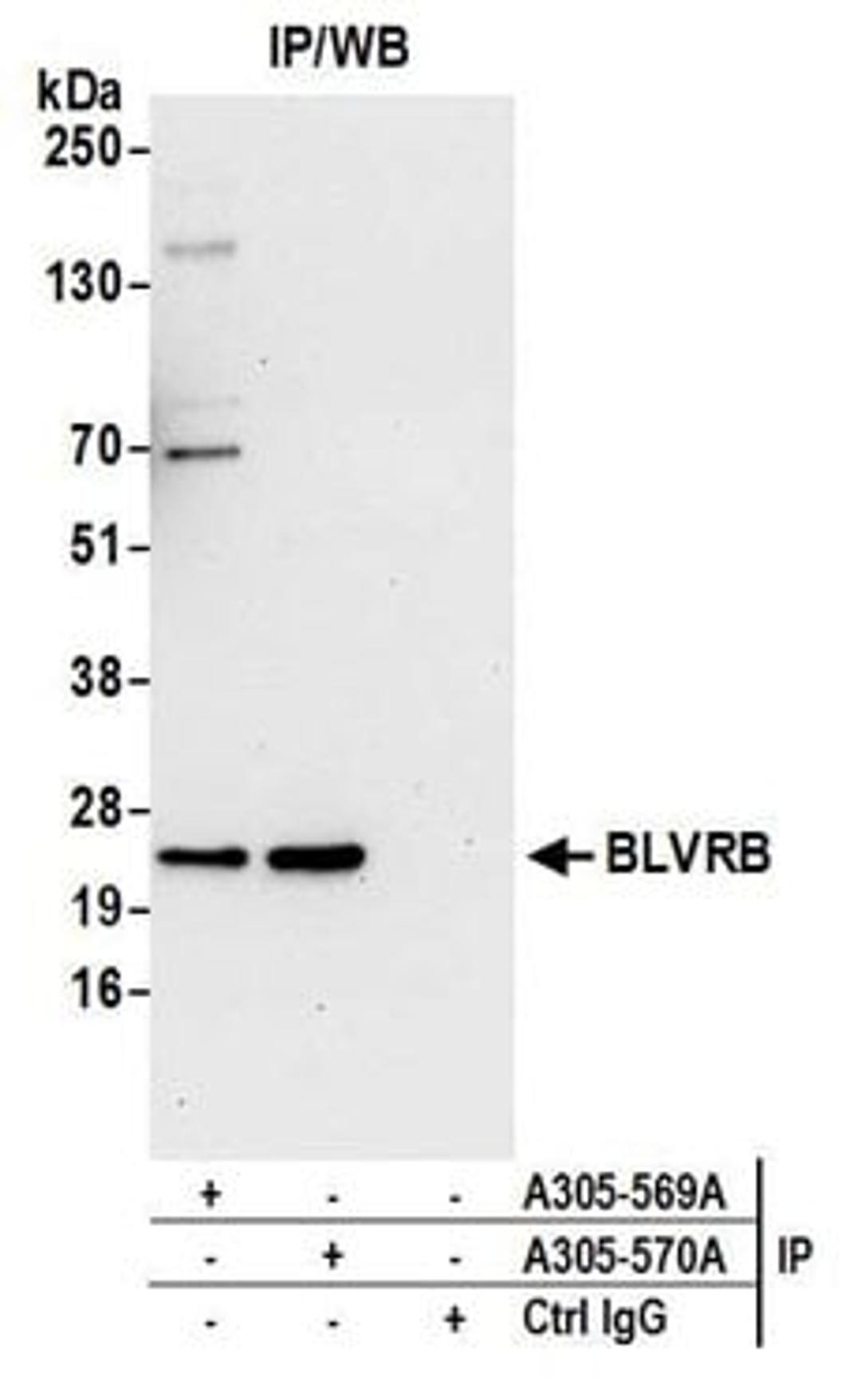 Detection of human BLVRB by western blot of immunoprecipitates.