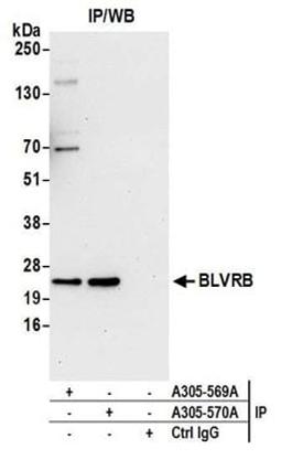 Detection of human BLVRB by western blot of immunoprecipitates.