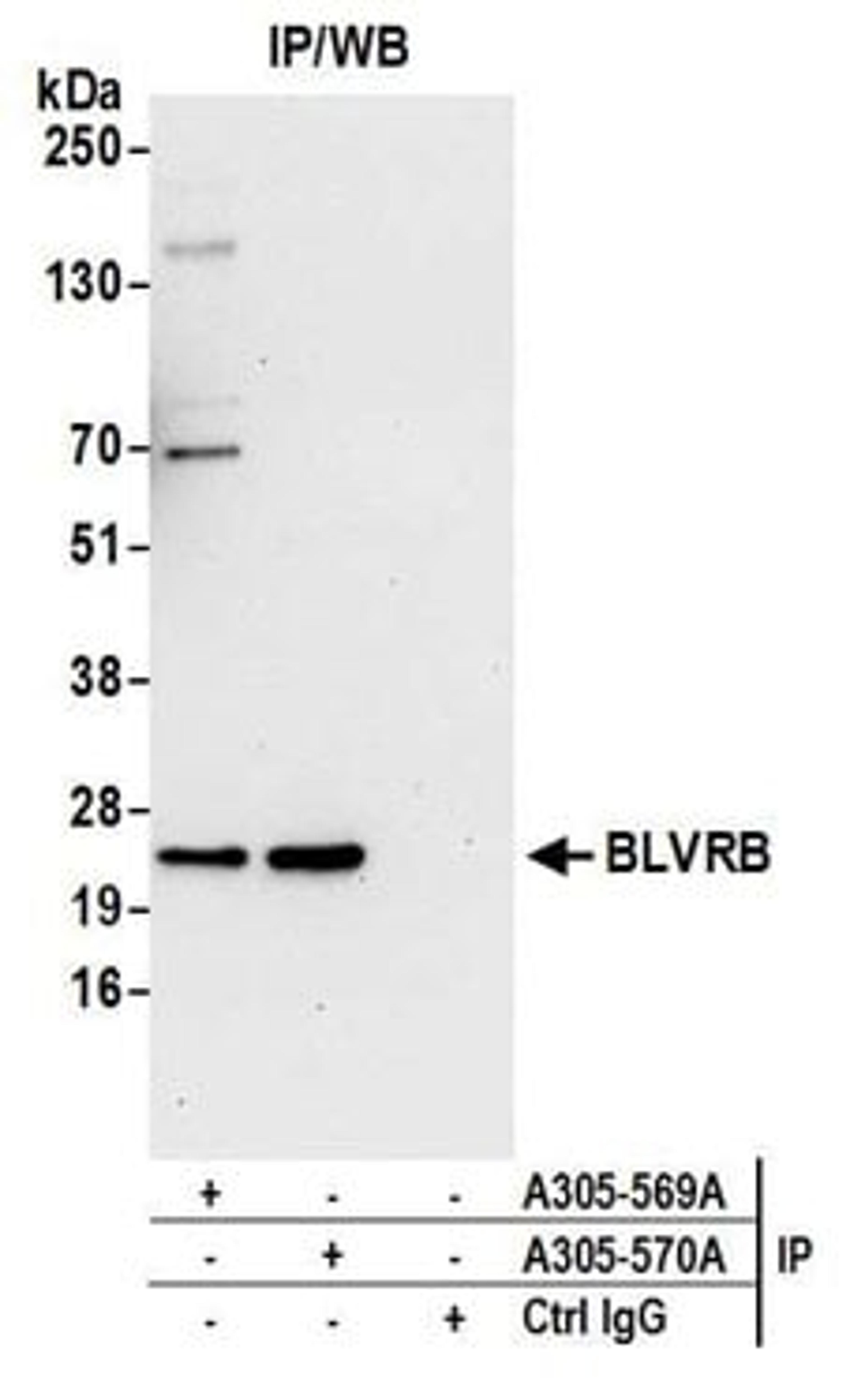 Detection of human BLVRB by western blot of immunoprecipitates.