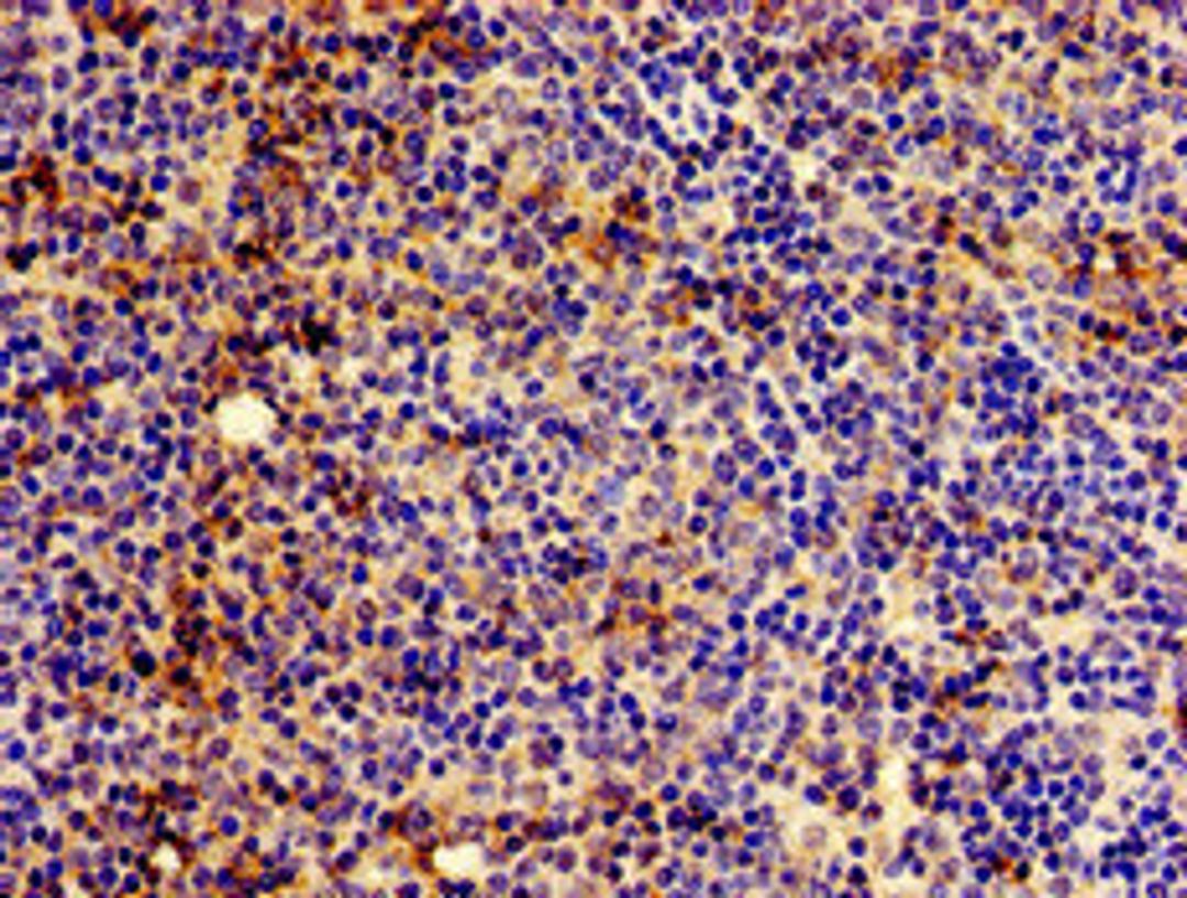 Immunohistochemistry of paraffin-embedded human lymph node tissue using CSB-PA356221LA01HU at dilution of 1:100