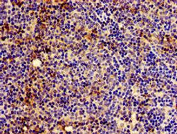 Immunohistochemistry of paraffin-embedded human lymph node tissue using CSB-PA356221LA01HU at dilution of 1:100