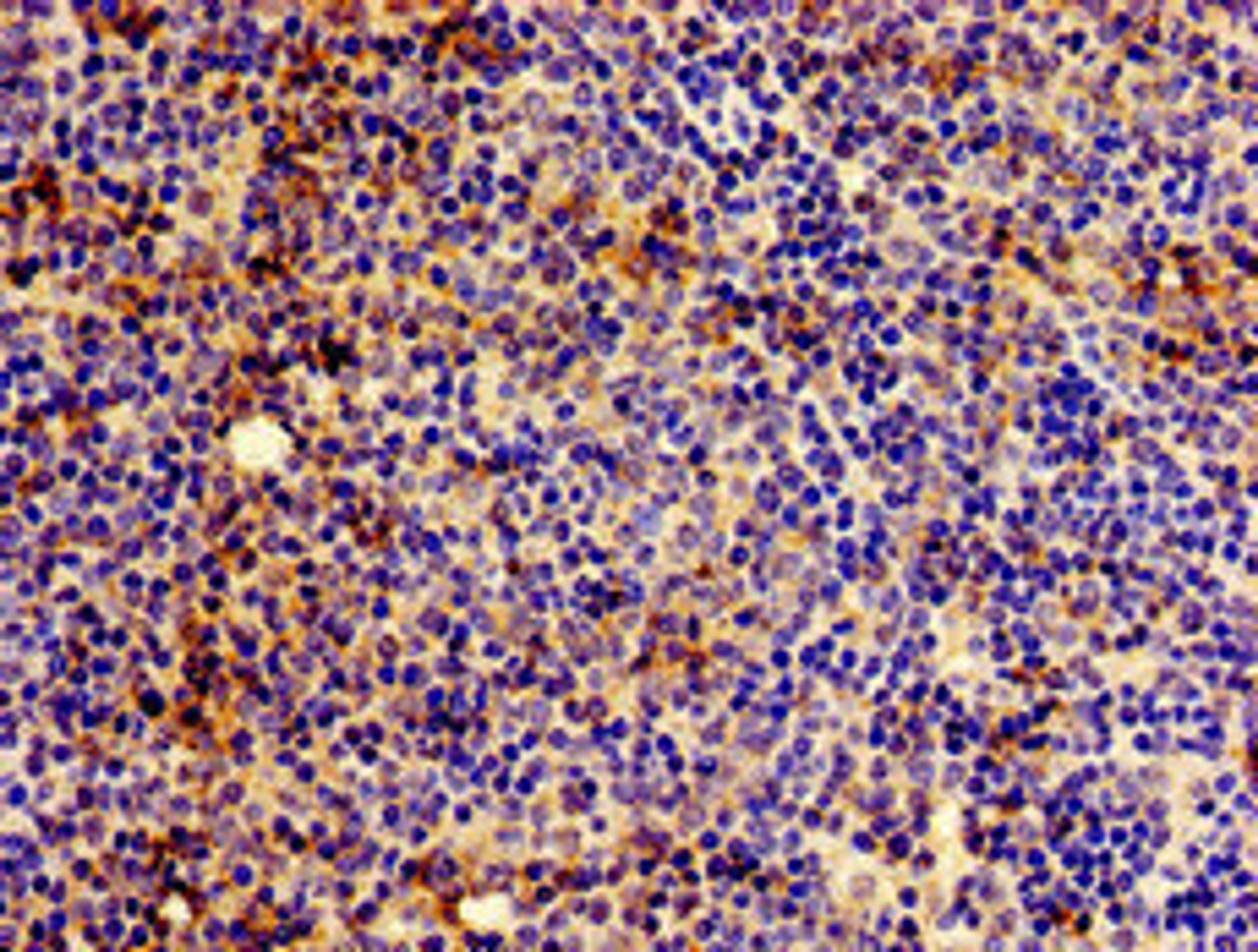 Immunohistochemistry of paraffin-embedded human lymph node tissue using CSB-PA356221LA01HU at dilution of 1:100