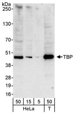 Detection of human TBP by western blot.