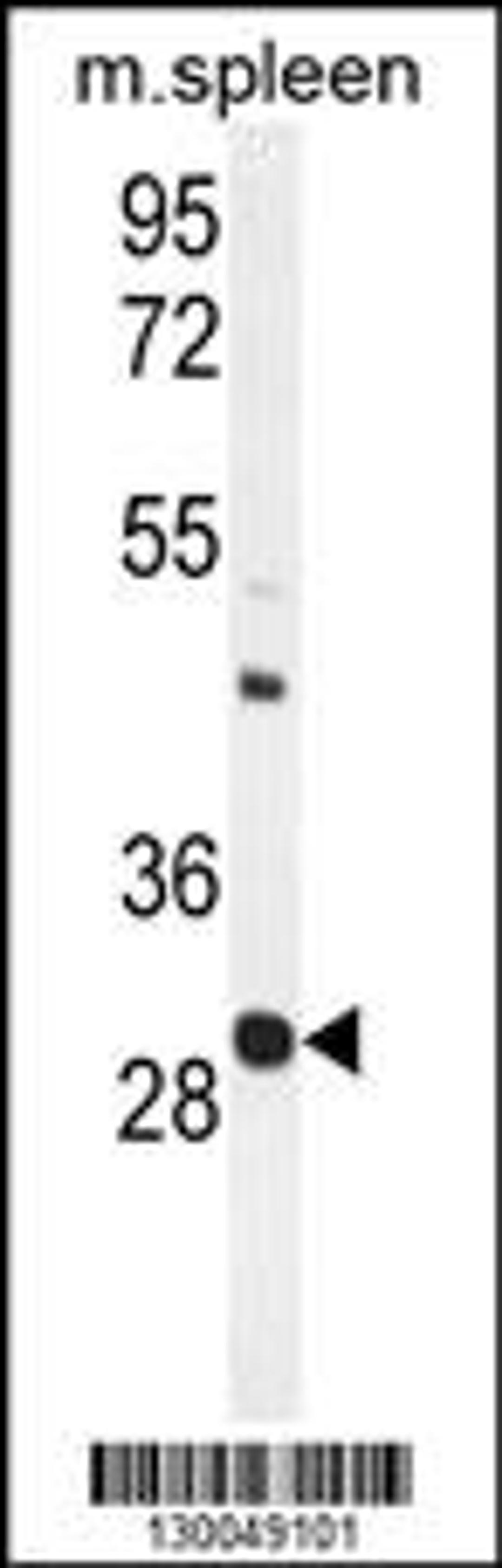 Western blot analysis in mouse spleen tissue lysates (35ug/lane).