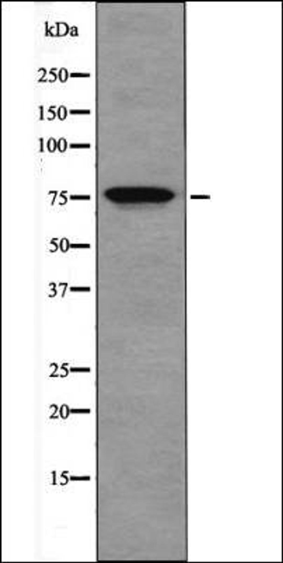 Western blot analysis of Jurkat whole cell lysates using OCT1 -Phospho-Ser385- antibody