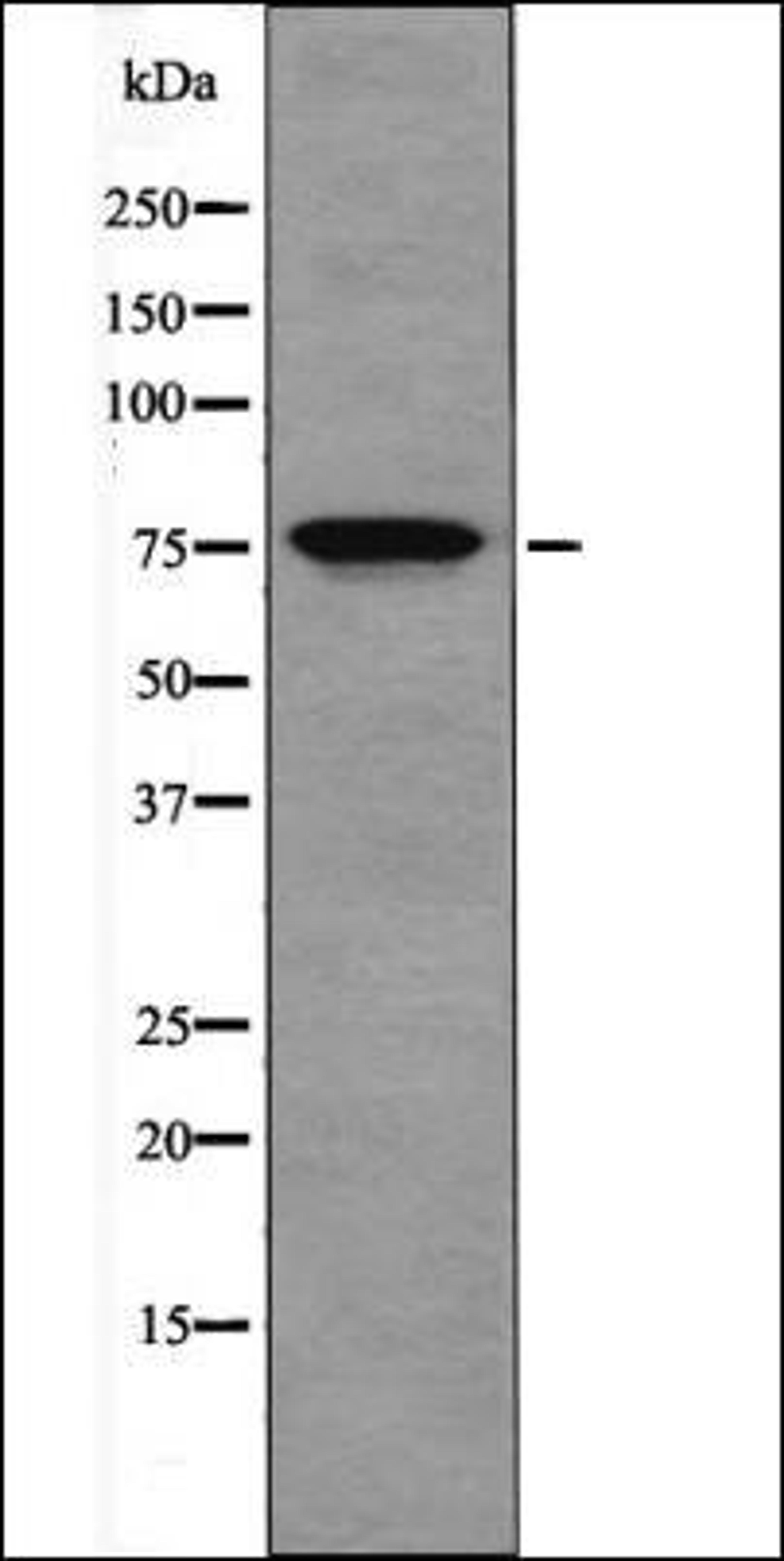 Western blot analysis of Jurkat whole cell lysates using OCT1 -Phospho-Ser385- antibody