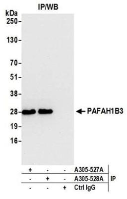 Detection of human PAFAH1B3 by western blot of immunoprecipitates.