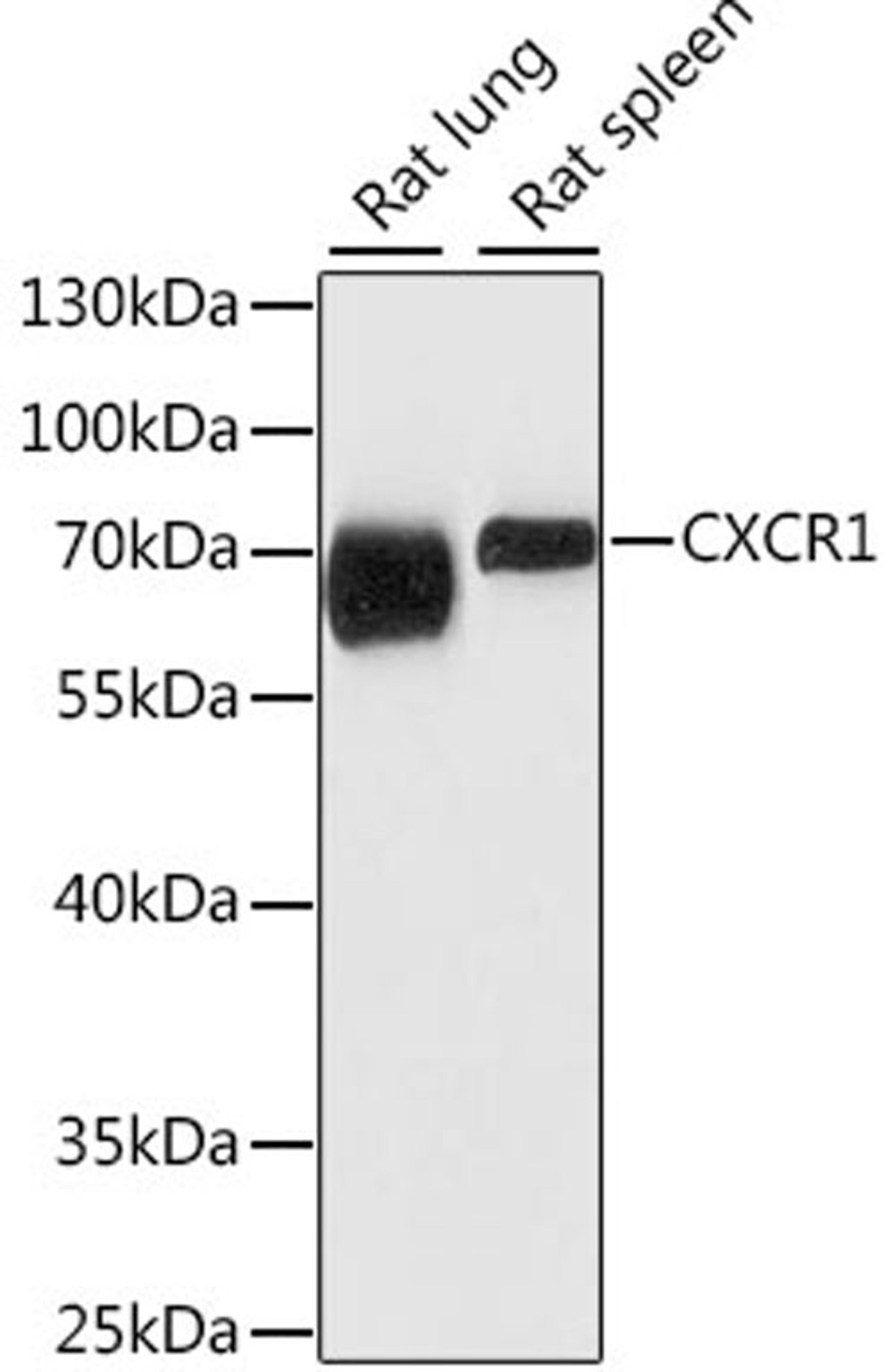 Western blot - CXCR1 antibody (A16386)