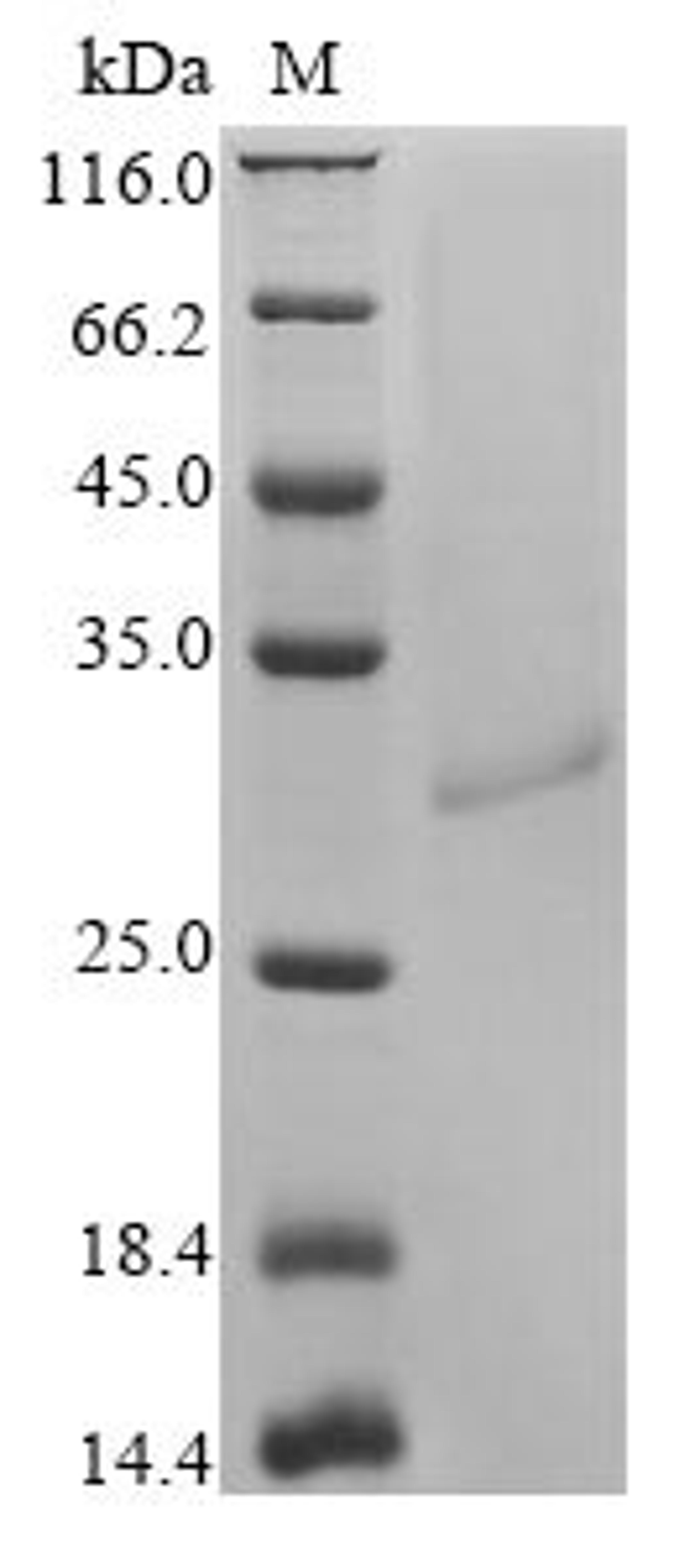 (Tris-Glycine gel) Discontinuous SDS-PAGE (reduced) with 5% enrichment gel and 15% separation gel.